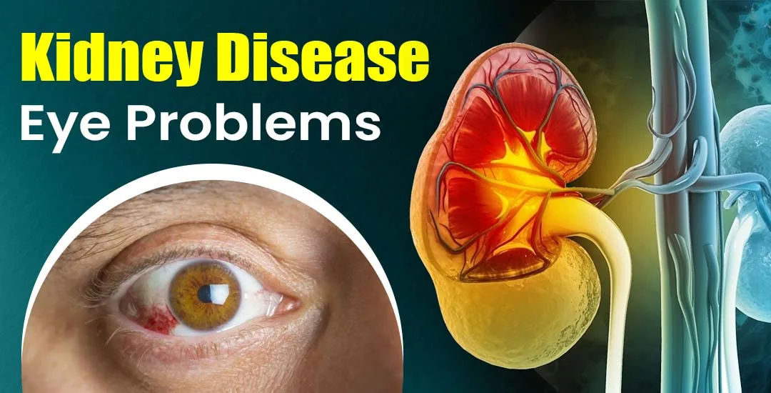 Can Kidney Disease Cause Eye Problems?